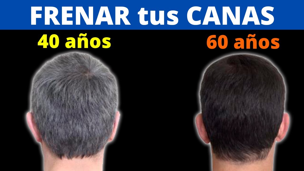 Cómo Detener Las Canas Naturalmente