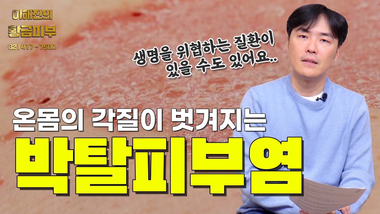 피부가 벗겨지고 발적이 생기는 질환 박탈피부염 / 연세에이앤비 피부과 이해진원장