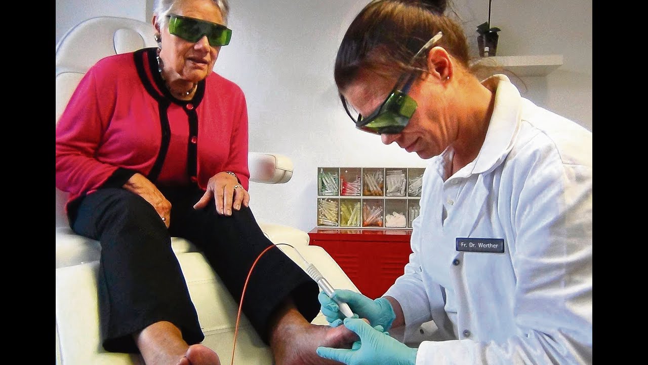 So wird Nagelpilz bekämpft