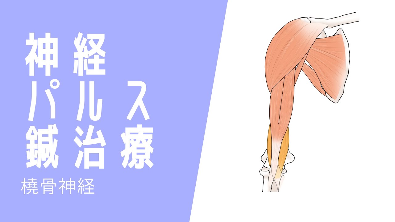 橈骨神経パルス｜電気鍼、ピコリナ使用