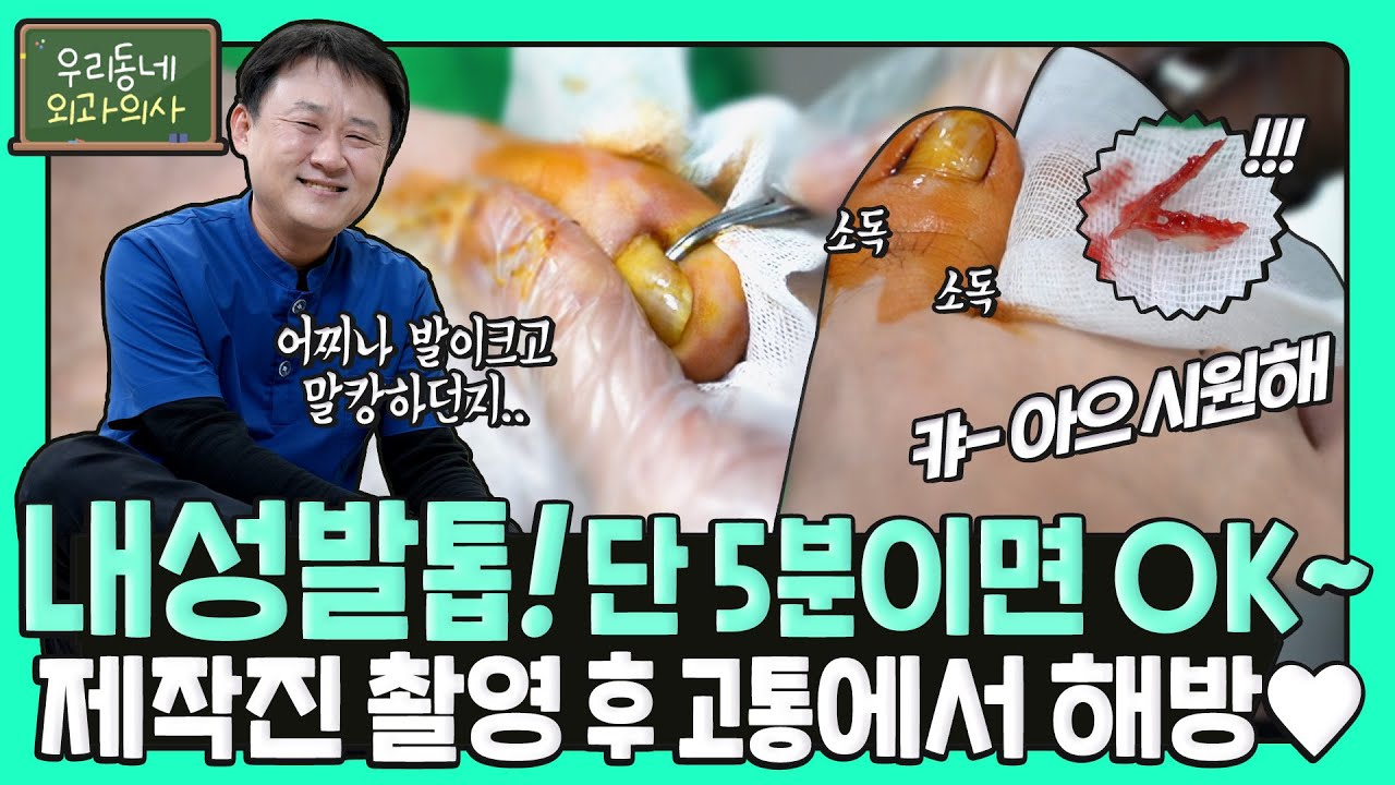 클릭 ◀  발톱이 살을 파고드는 【내성발톱】치료 방법! 약 5분만에 고통에서 해방!