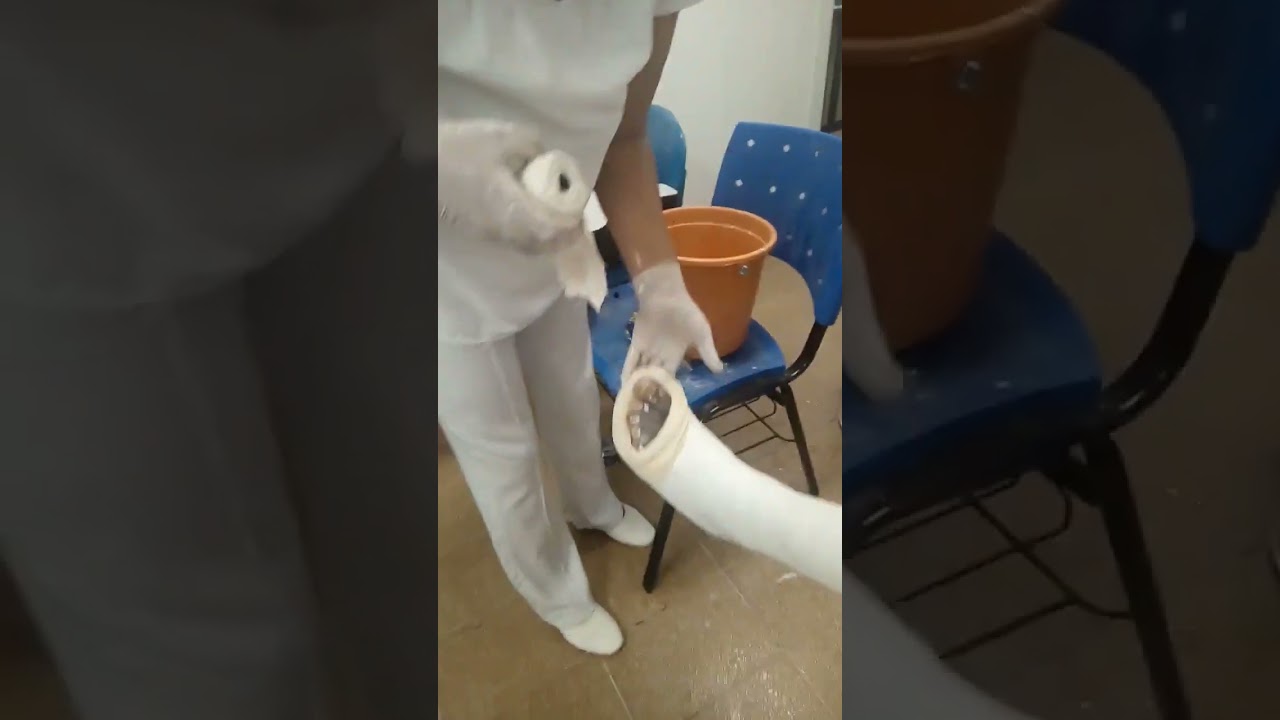 DUAS  BOTA GESSADA  OU  GESSO  SURO PODALICO