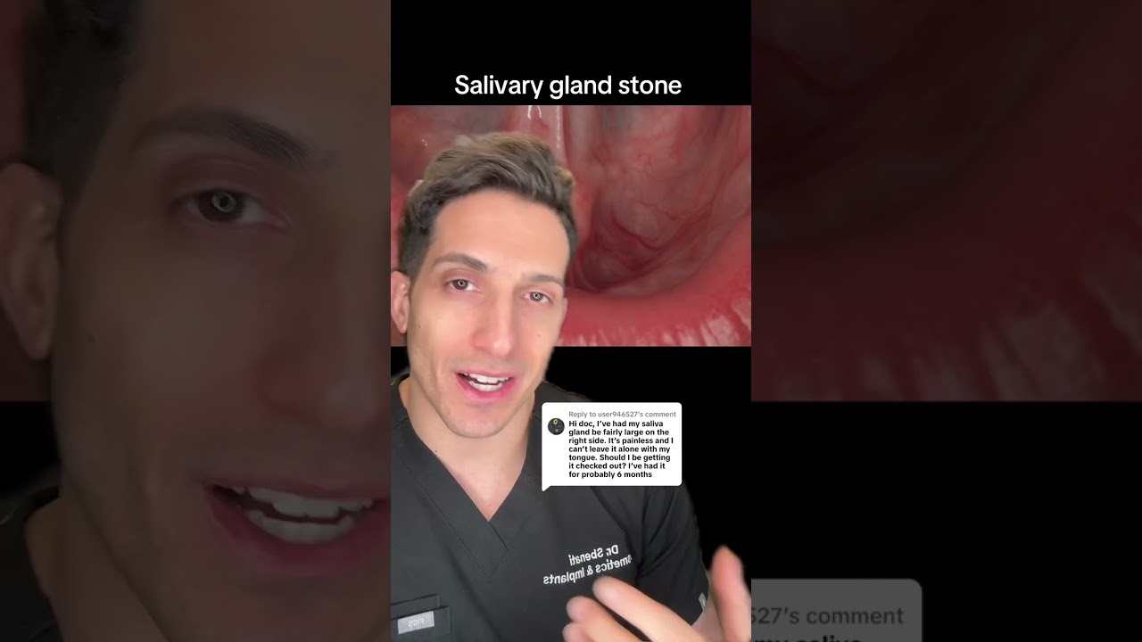 Enlarged Salivary Gland? Should You Be Worried?