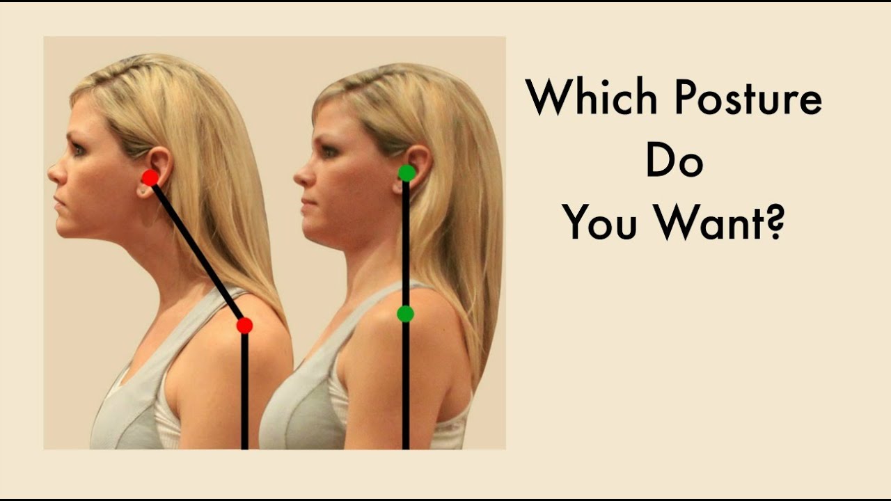 Forward Head Posture Correction Exercises - Fix Ugly Forward Head Posture Video #2