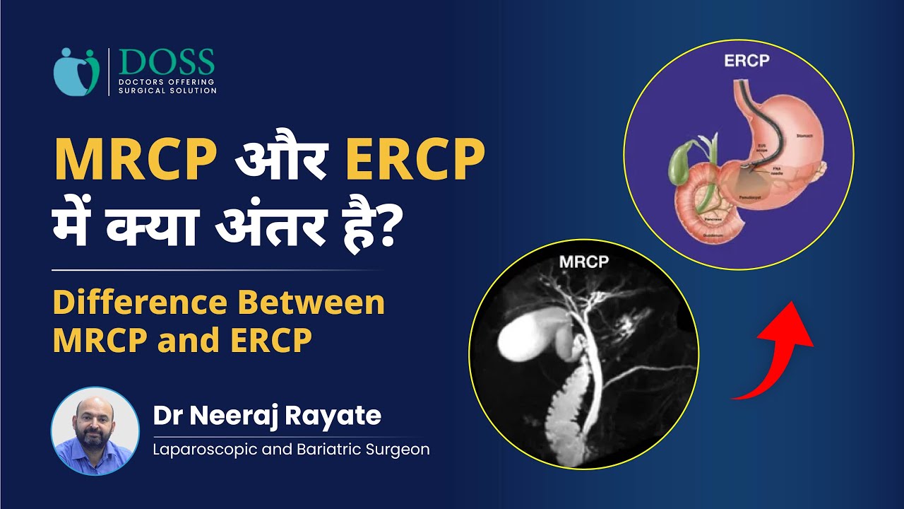 MRCP और ERCP में क्या अंतर है? | Difference Between MRCP and ERCP | Dr Neeraj Rayate, Pune