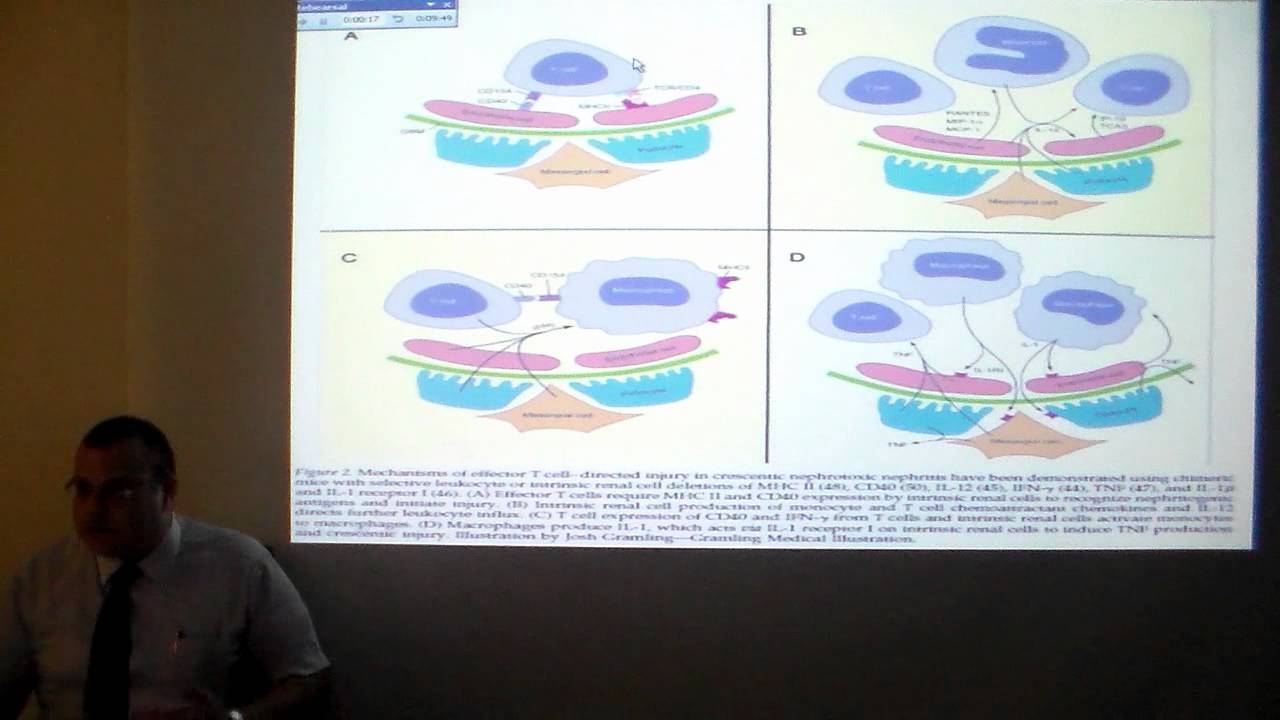 Crescentic GN  Dr  Bahaa Zayed  Cairo University