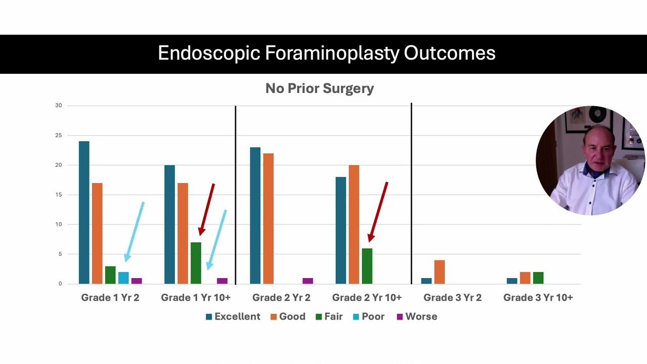 Endoscopic Foraminoplasty treatment of Adult Spondylolytic Spondylolisthesis - Outcomes