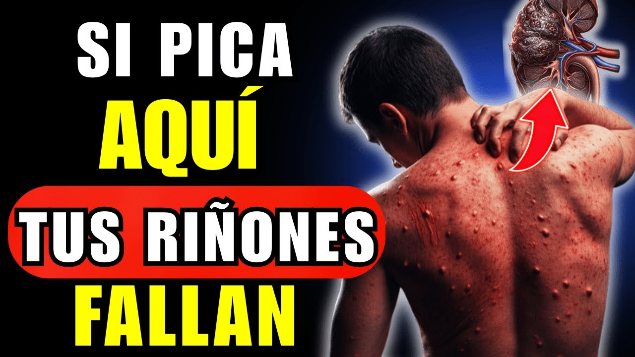 PICAZÓN en MANOS, PIES o CUERPO: 3 Alertas de tus RIÑONES (No Ignores)