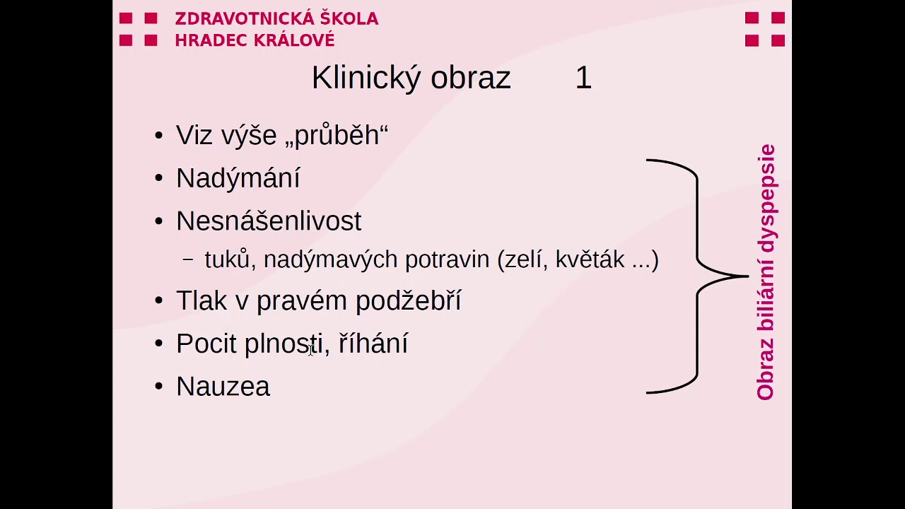 Cholelithiasa