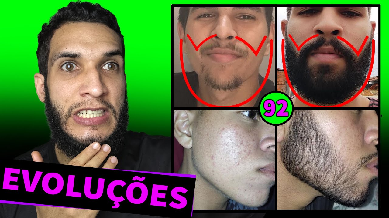 EVOLUÇÃO DOS INSCRITOS / MINOXIDIL #92 🔥