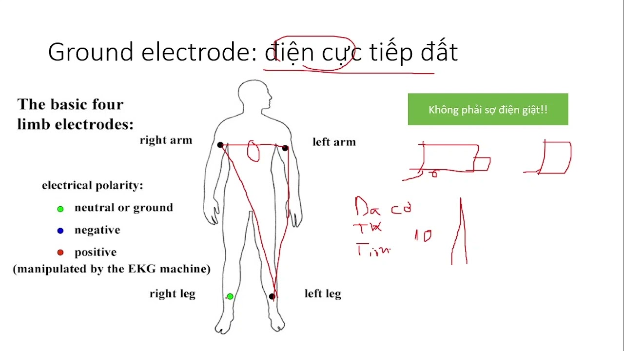 Cơ chế điện tâm đồ (ECG) | Y3