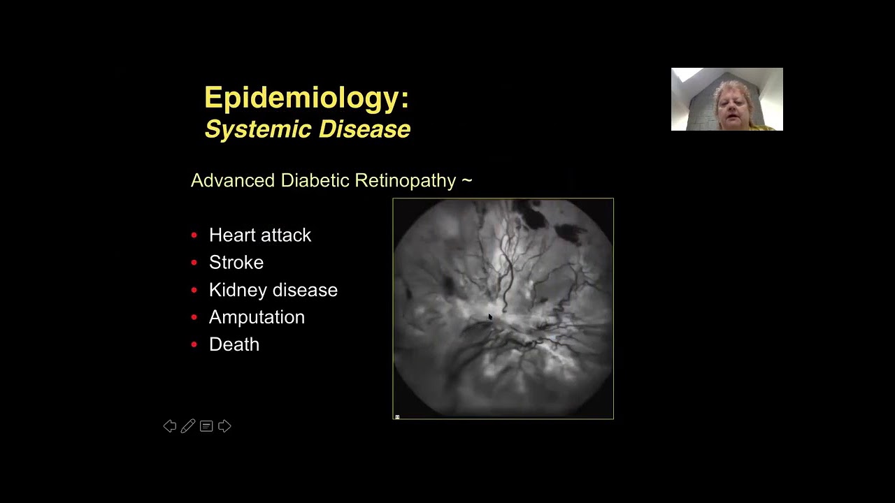 STOP Diabetic Retinopathy: Skills Training in Ophthalmic Photocoagulation
