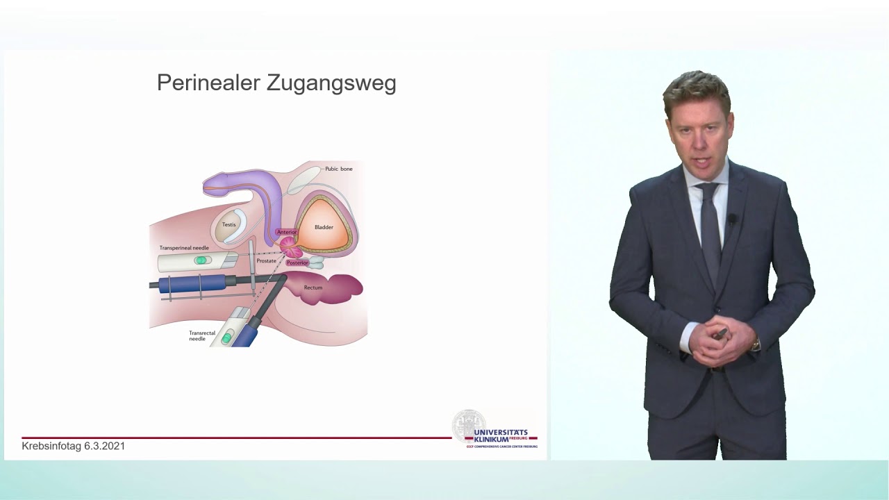 Wie hilfreich ist der PSA Wert? | Prof. Dr. Christian Gratzke, Klinik für Urologie