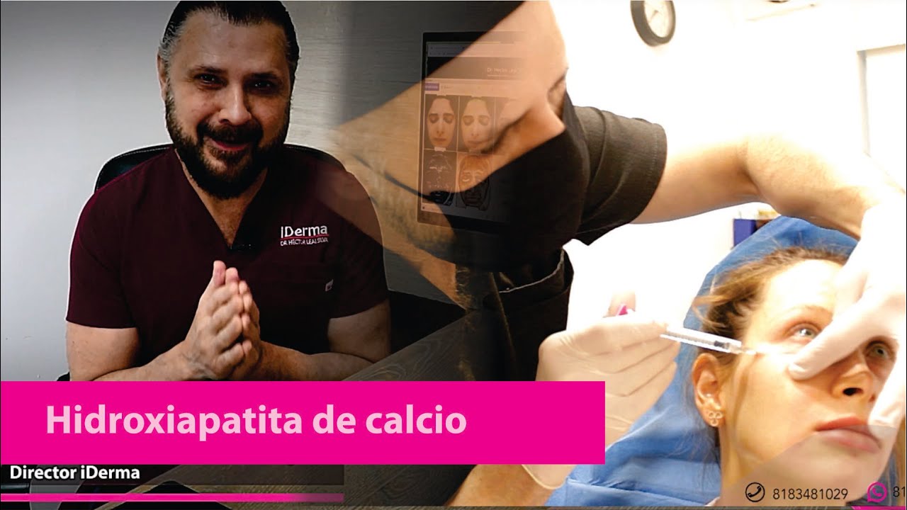 HIDROXIAPATITA DE CALCIO