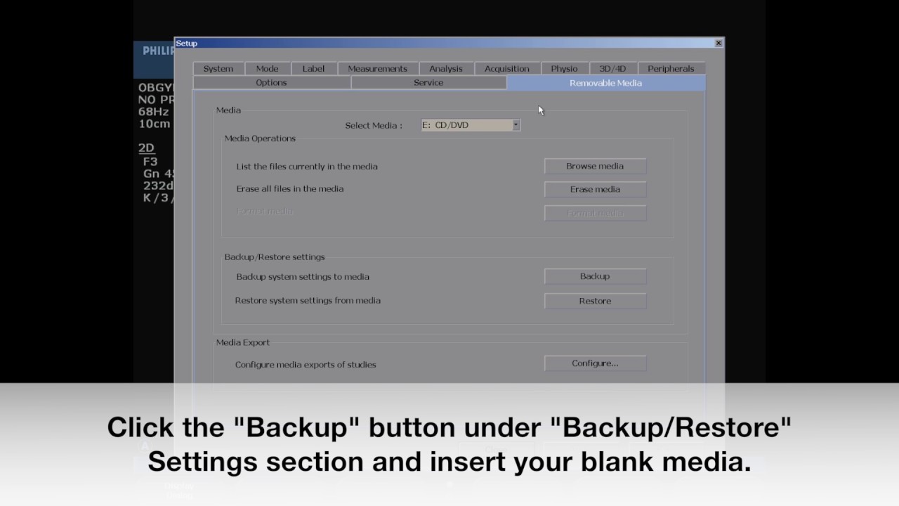 Philips HD11 Licensed Options Backup