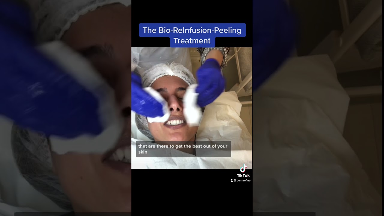 The Bio-Re-Infusion-Peeling Treatment