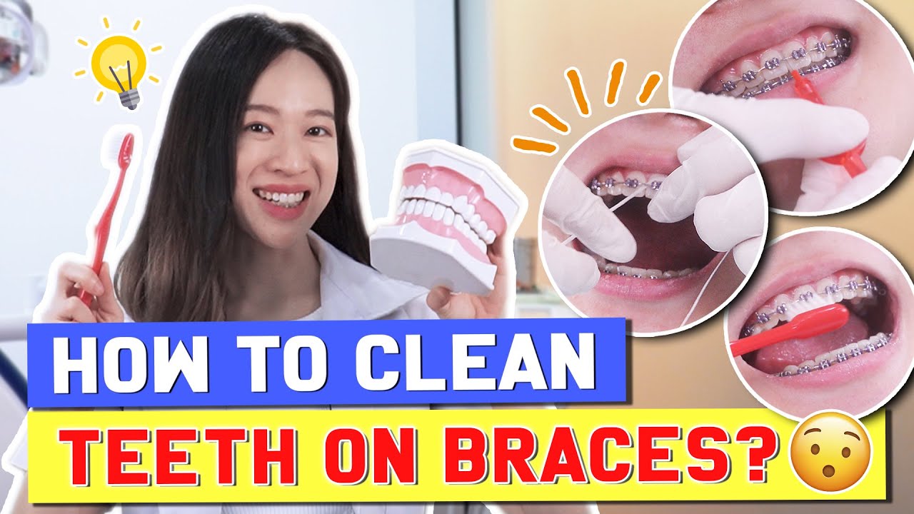 How To BRUSH & FLOSS TEETH with BRACES?  | #BraceYourself!🦷