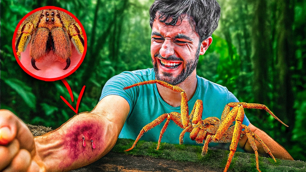 Picado por ARA&Ntilde;A BANANERA!!! Las Peores Picaduras #6