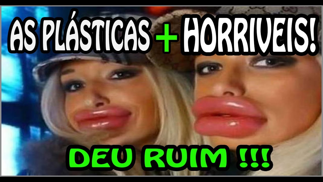 🔴 Pl&aacute;sticas Terr&iacute;veis! As Pl&aacute;sticas dos famosos que deram errado! PARTE 1