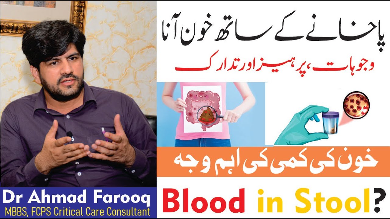 Anal Fissure || Blood in stool causes, preventions & Treatment in Urdu/Hindi