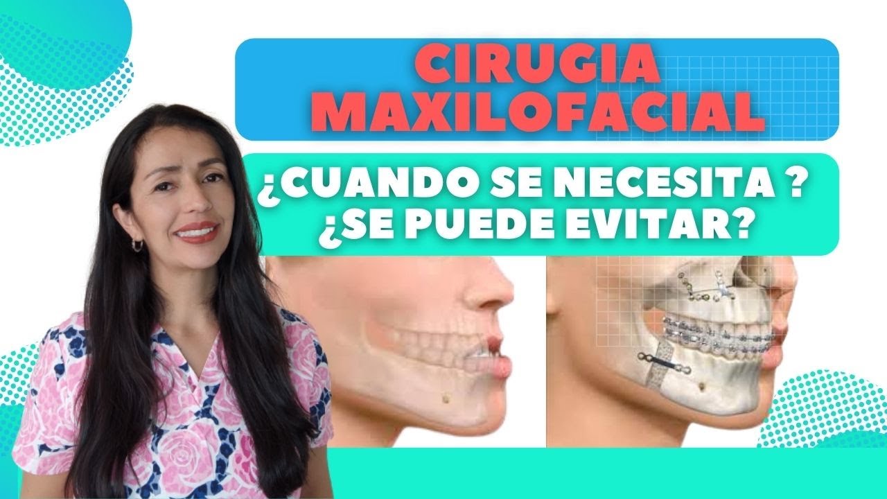 Cirugia Maxilofacial ¿cuando se necesita?