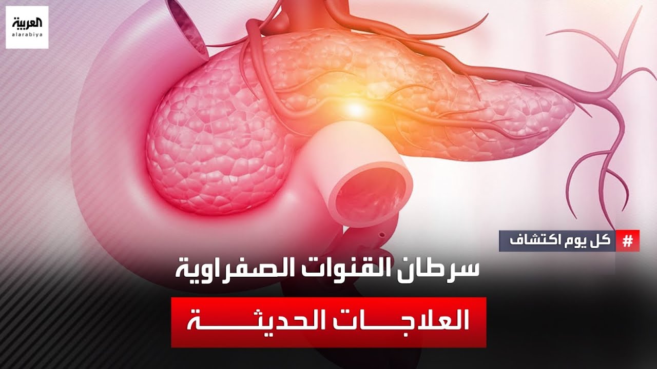 سرطان القنوات الصفراوية.. العلاجات الحديثة