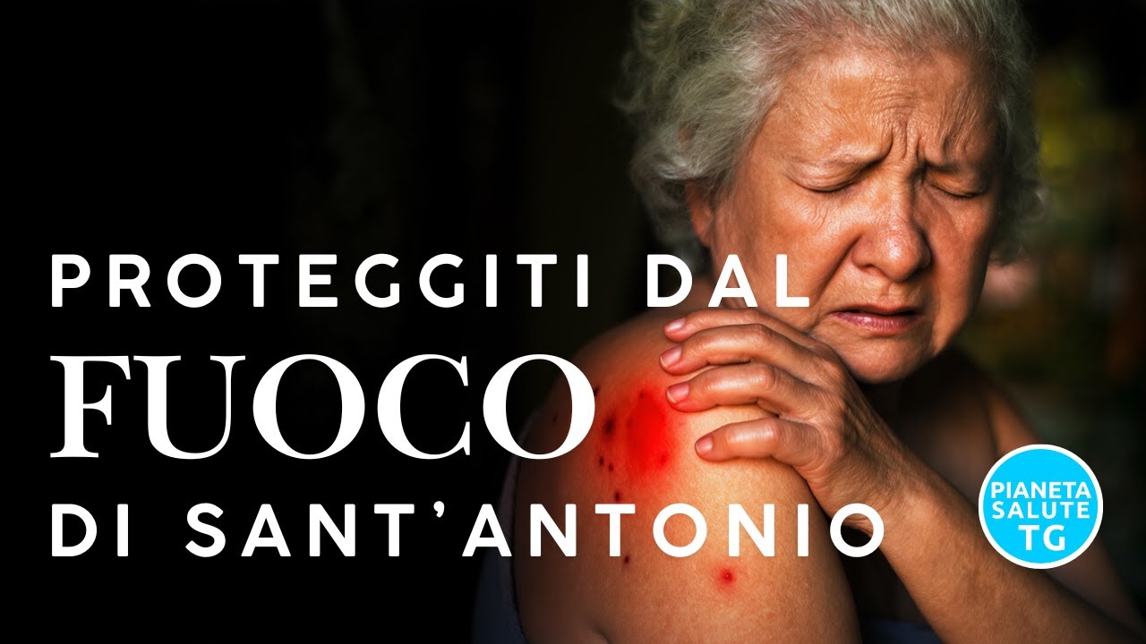 Herpes Zoster: Cos’è, Sintomi e Vaccino per il Fuoco di Sant’Antonio