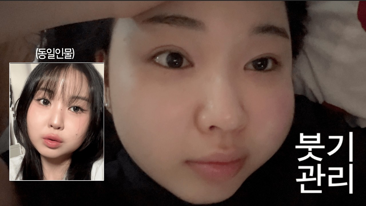 매일 얼굴이 두쫀쿠처럼 붓는 사람의 현실 다이어트 브이로그 | 붓기루틴·홍조관리·식단