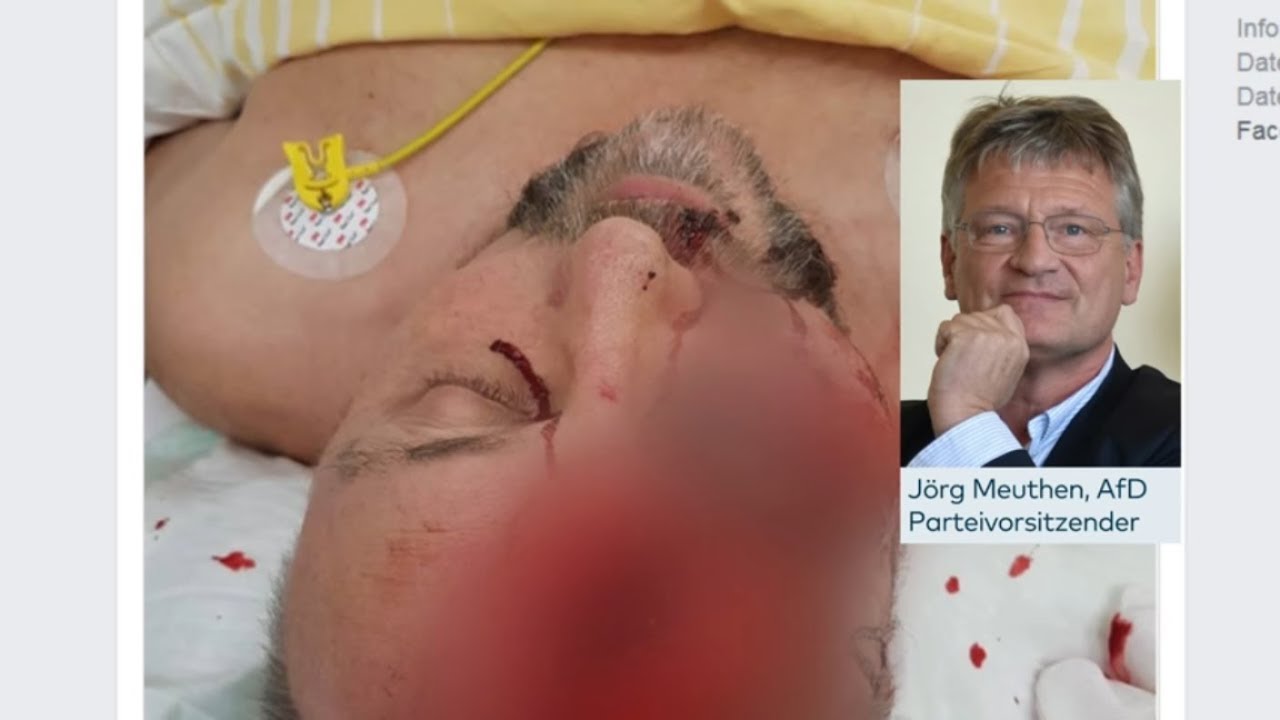 MEUTHEN ZU ATTACKE: 