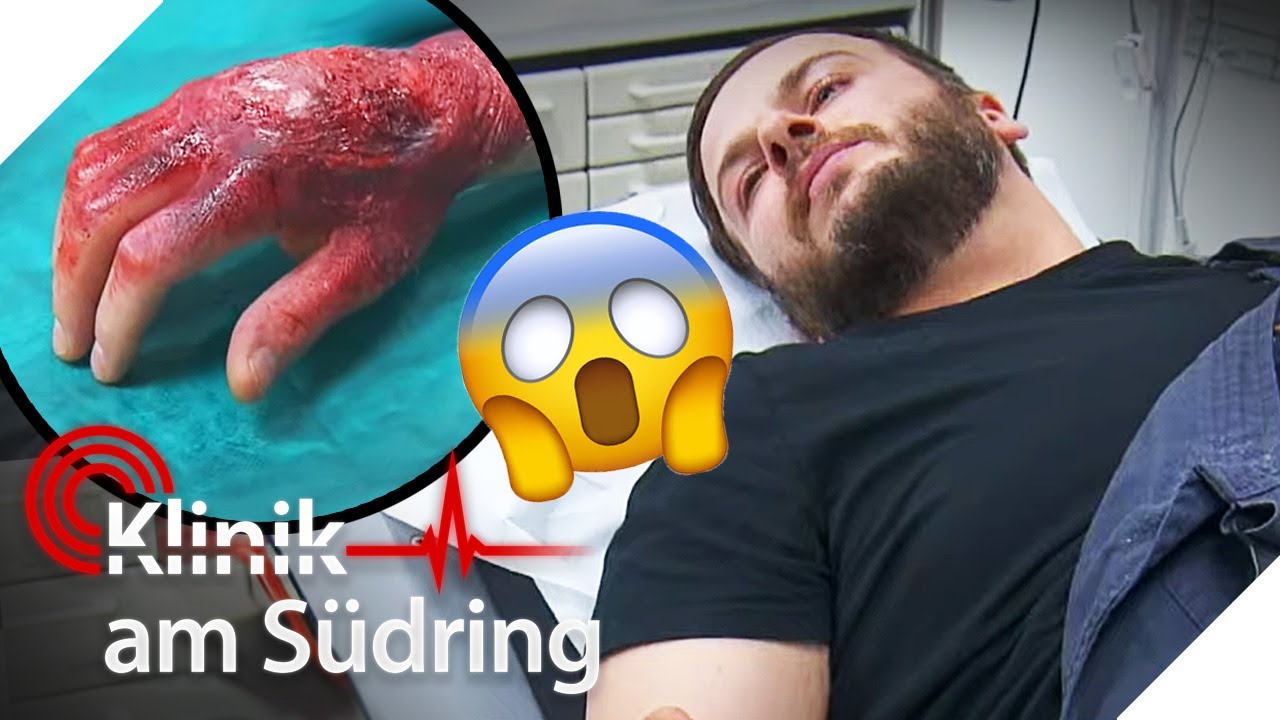 Schlimmer geht's kaum 😲 Handwerker bangt um seine Hand - muss sie ab? | Klinik am Südring | SAT.1