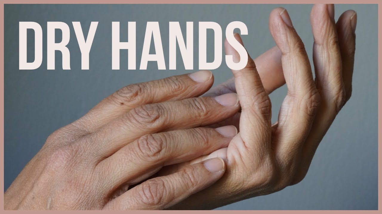 How to treat your Dry Hands with Oils