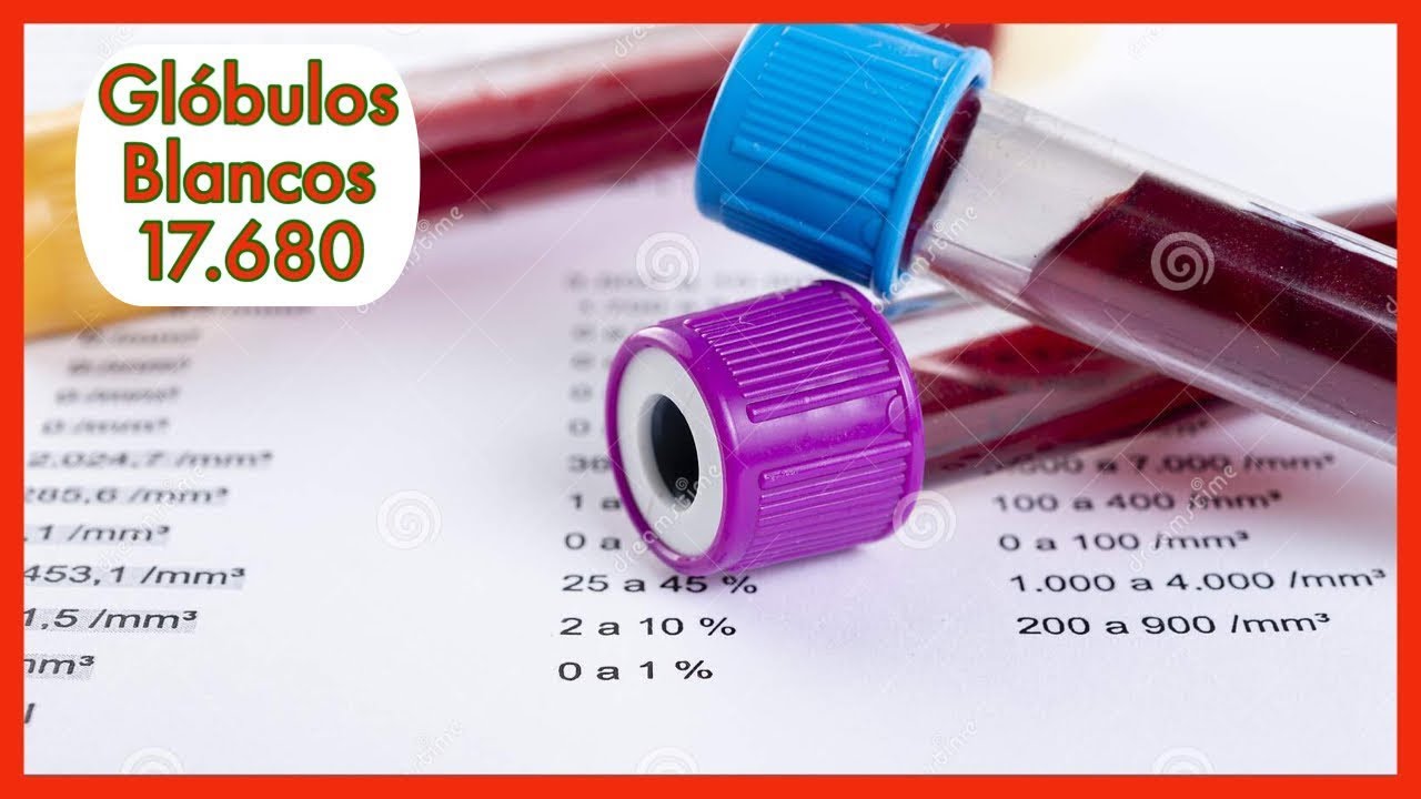 ¿Qué es un hemograma completo y cómo leerlo fácil?