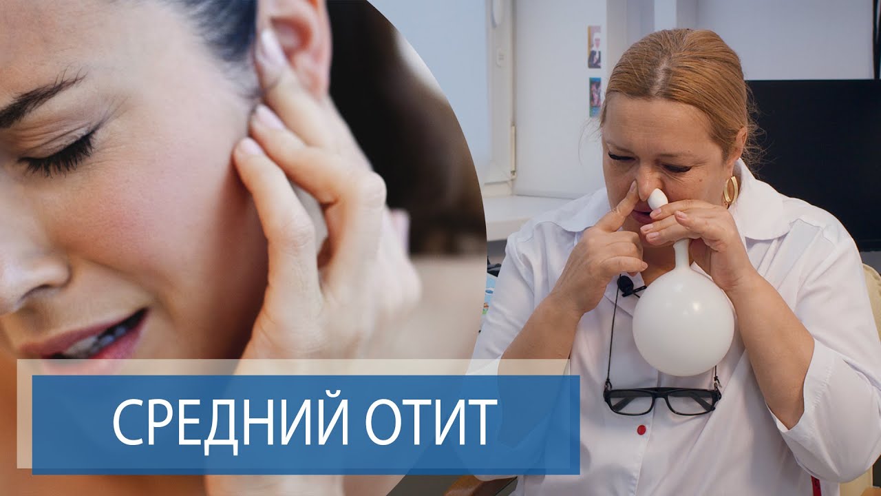 Тубоотит,  Гнойный средний отит,  Острый отит | Лечение и профилактика | Гигиена слуха