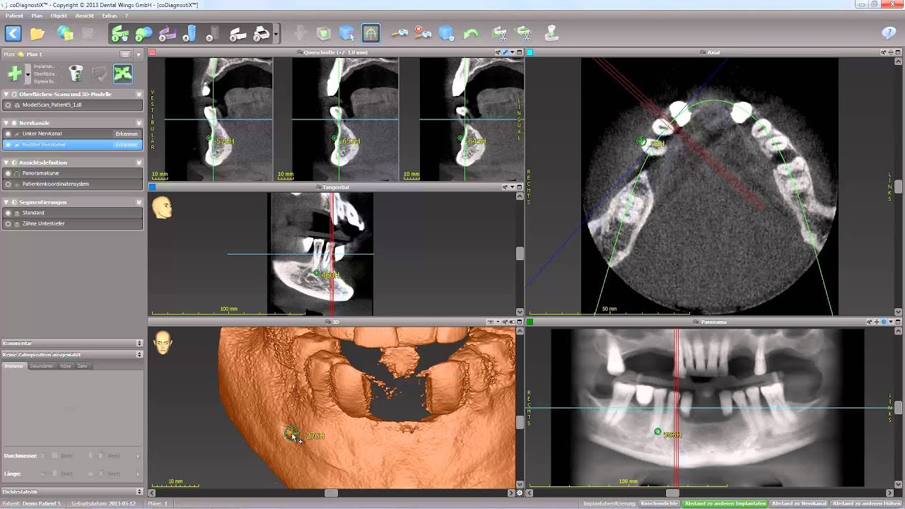 coDiagnostiX 9: Digitaler Workflow