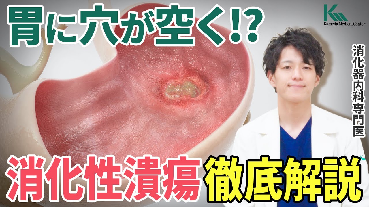 【解説】痛み止め薬も原因に？胃潰瘍や十二指腸潰瘍について徹底解説！（消化性潰瘍）