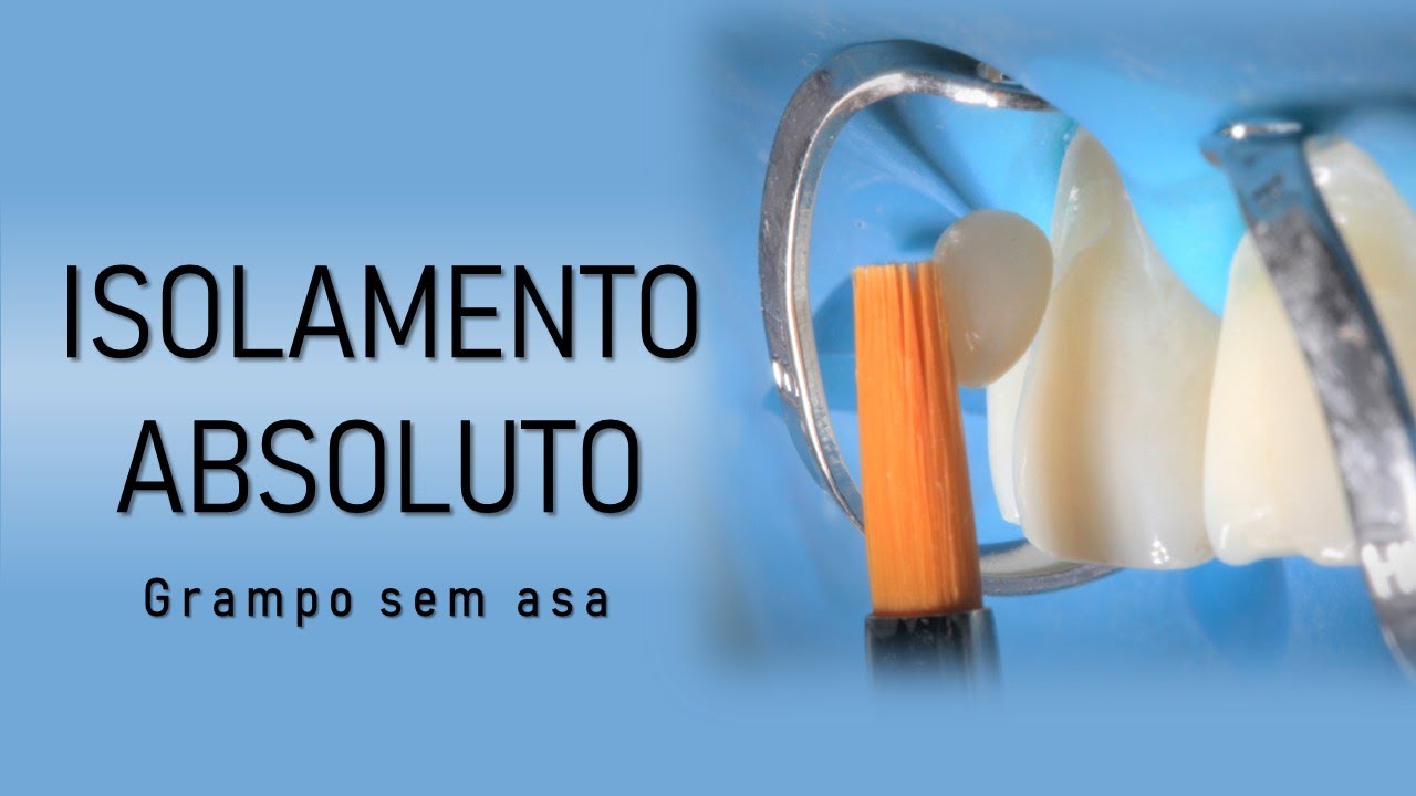 Isolamento absoluto com grampo sem asa