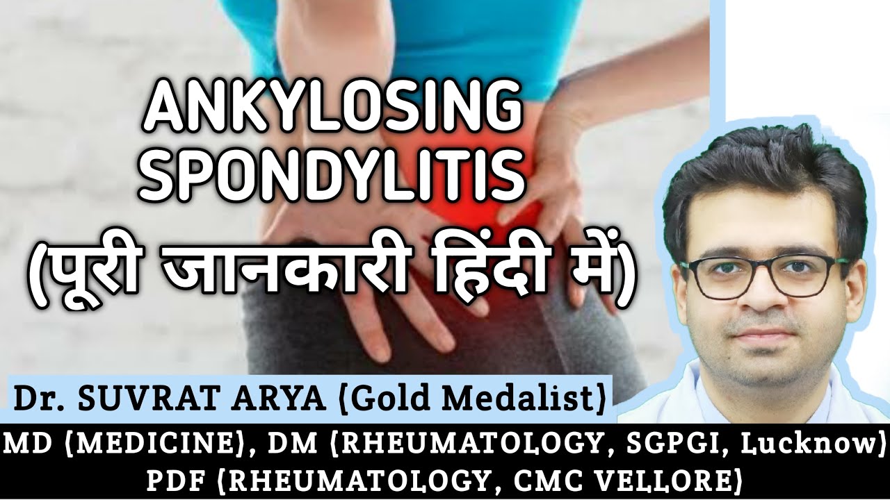 Ankylosing Spondylitis की पूरी जानकारी हिंदी में। Dr. Suvrat Arya, DM Rheumatology (Gold Medalist)