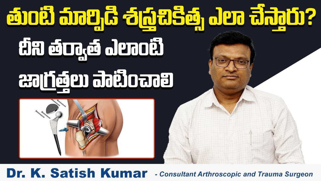 తుంటి మార్పిడి శస్త్రచికిత్స || Types of Hip Replacement Surgery in Telugu || V9 Hospitals