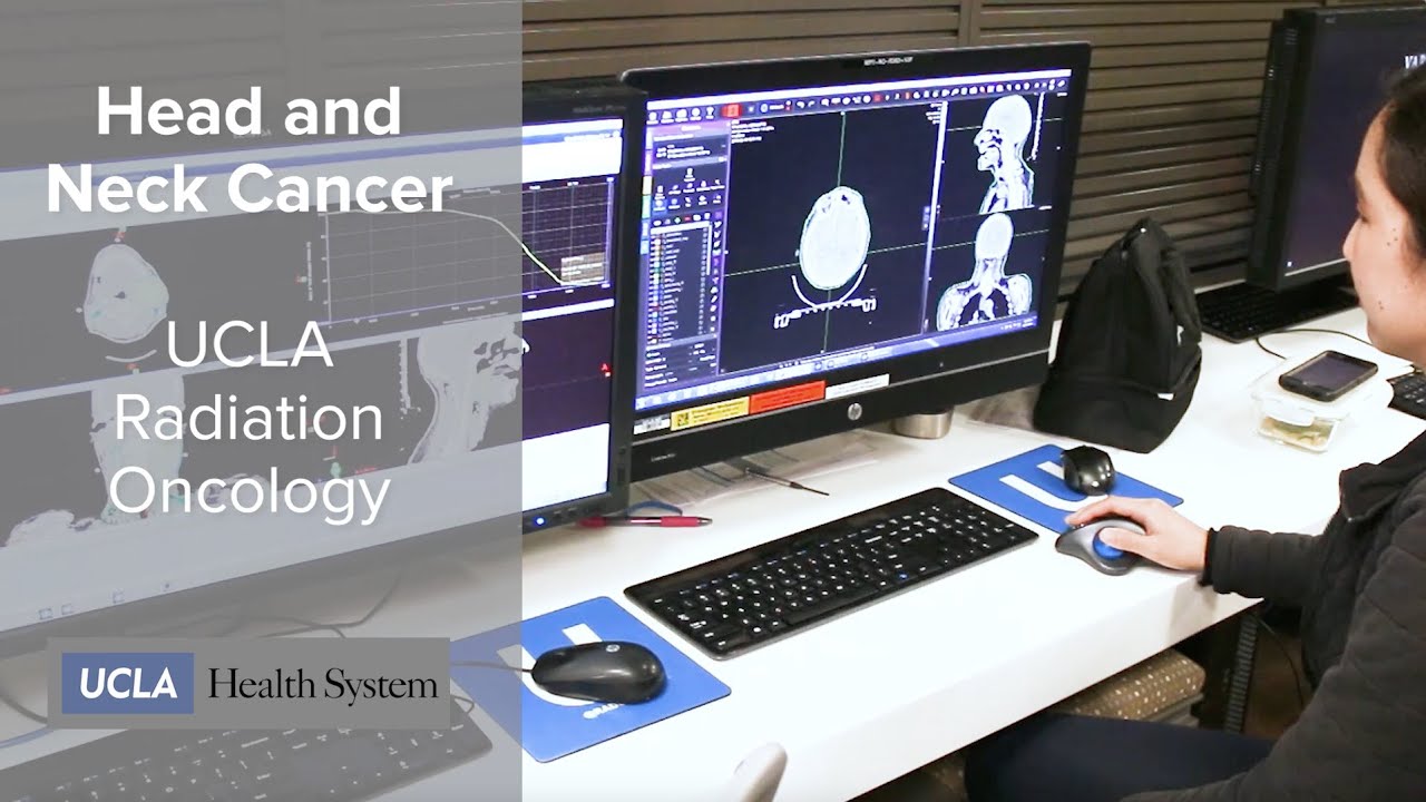 Clinical Trial: Squamous Cell Cancers of the Head & Neck - Robert Chin, MD | UCLA Radiation Oncology