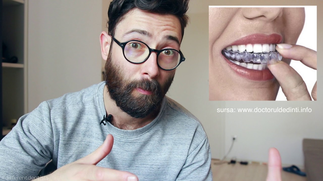De ce ne dor dintii? / Dentistry Hub