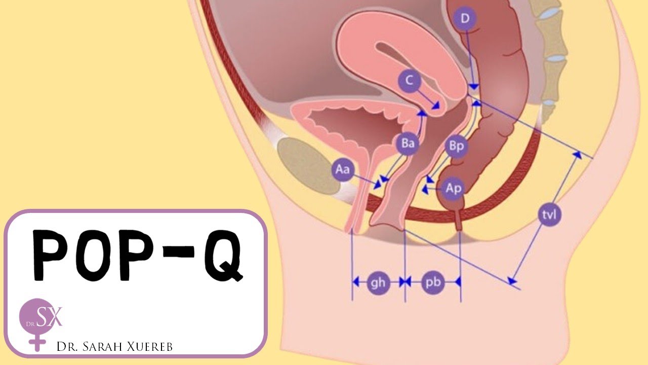 POP-Q