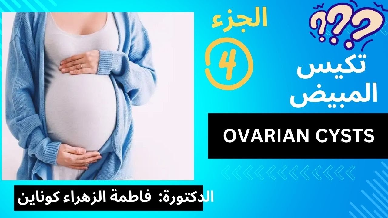 تكيس المبيض 4