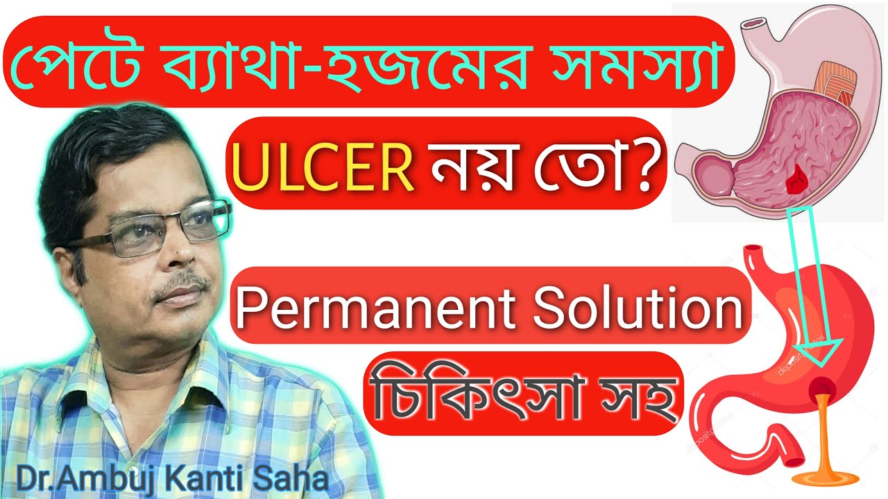 Peptic ulcer treatment | Gastric ulcer duodenal ulcer symptoms, treatment & home remedies in Bengali