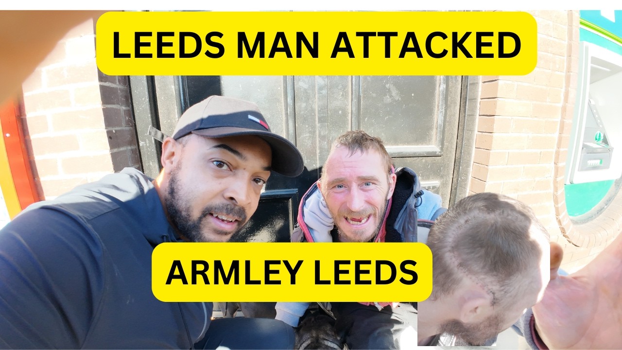 LEEDS MAN ATTACKED IN ARMLEY