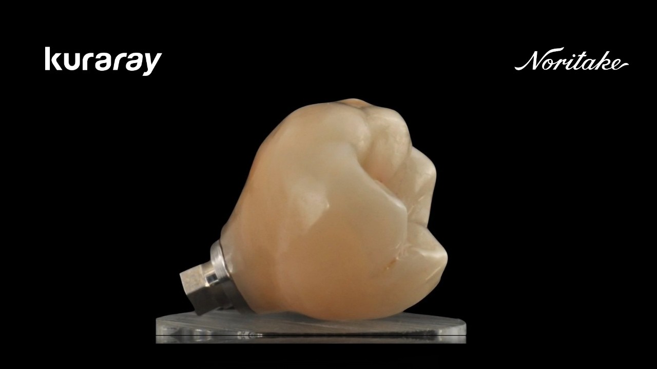TiBase Cementation with PANAVIA V5 | Step-by-Step Dental Lab Protocol