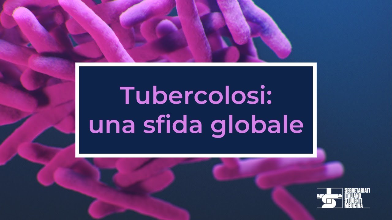 Turbercolosi: una sfida globale