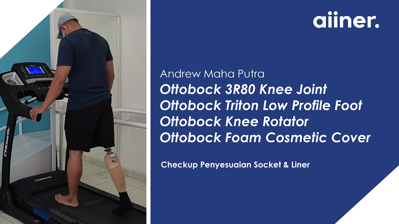 Penyesuaian Socket & Liner pada Kaki Palsu Atas Lutut - Ottobock 3R80 & Triton Low Profile | Aiiner