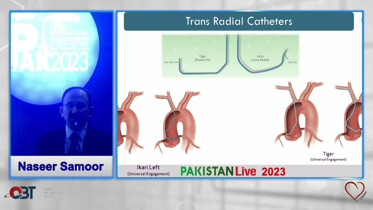 Selecting Coronary Guide Catheters for Success by Naseer Samoor
