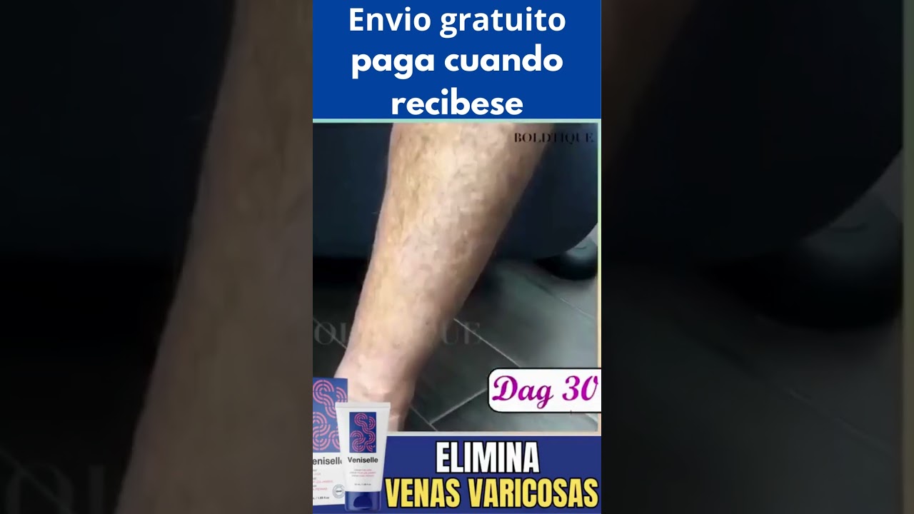 Veniselle Crema Revolucionaria Sin Dolor dile Adi&oacute;s a las Varices