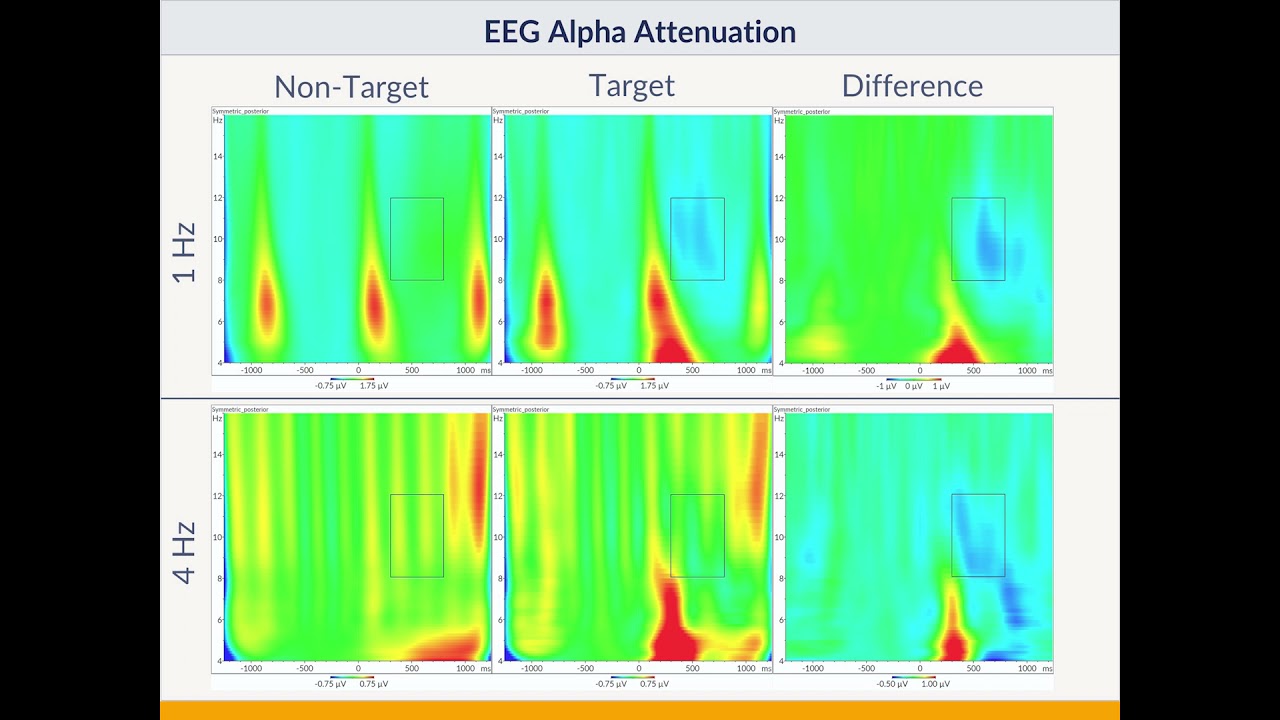SFN 2021: Target-related Alpha Attenuation in a Brain Computer Interface